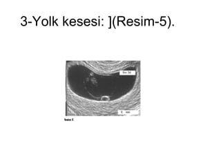 3-Yolk kesesi: ](Resim-5).  