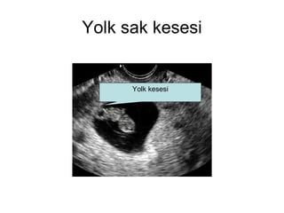 Yolk sak kesesi Yolk kesesi 