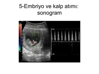 5-Embriyo ve kalp atımı:  sonogram 
