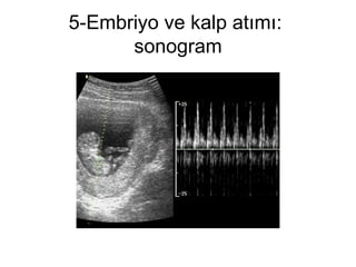 5-Embriyo ve kalp atımı:  sonogram 