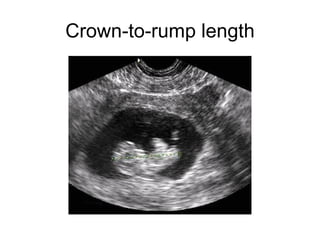 Crown-to-rump length 
