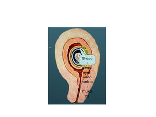 G-sac ı çevreleyen endometrial mukoza 