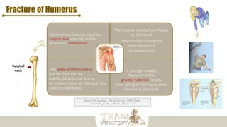 Fracture of Humerus
Most common fractures are of the
Surgical neck especially in elder
people with osteoporosis
The fracture results from falling
on the hand
(transition of force through the
bones of forearm of
the extended limb)
The body of the humerus
can be fractured by
a direct blow to the arm or
by indirect injury as falling on the
outstretched hand
In younger people,
fractures of the
greater tubercle results
from falling on the hand when
the arm is abducted
Surgical
neck
Body of the humerus .. the fracture by a DIRECT blow
‫مباشرة‬ ‫كدمة‬ ‫تلقي‬ ‫خالل‬ ‫من‬ ‫إال‬ ‫فيها‬ ‫الكسر‬ ‫حصول‬ ‫نادر‬
 