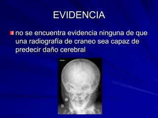 EVIDENCIA<br />no se encuentra evidencia ninguna de que una radiografía de craneo sea capaz de predecir daño cerebral<br />