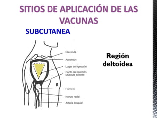SITIOS DE APLICACIÓN DE LAS
VACUNAS
SUBCUTANEA
Región
deltoidea
 