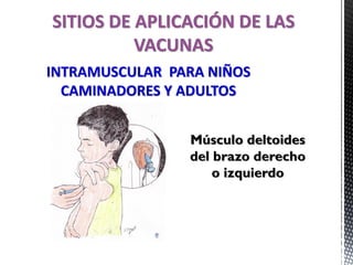 SITIOS DE APLICACIÓN DE LAS
VACUNAS
INTRAMUSCULAR PARA NIÑOS
CAMINADORES Y ADULTOS
Músculo deltoides
del brazo derecho
o izquierdo
 