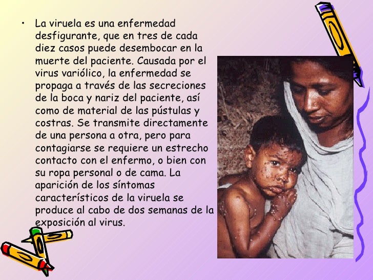 1. varila , viruela y sarampion