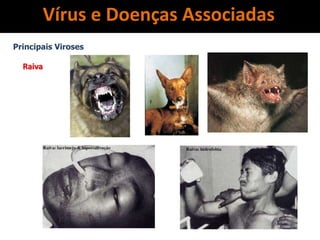 Vírus e Doenças Associadas
Principais Viroses
Raiva
 