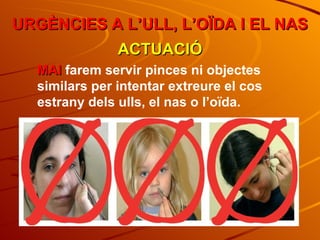 URGÈNCIES A L’ULL, L’OÏDA I EL NAS ACTUACIÓ MAI  farem servir pinces ni objectes similars per intentar extreure el cos estrany dels ulls, el nas o l’oïda. 
