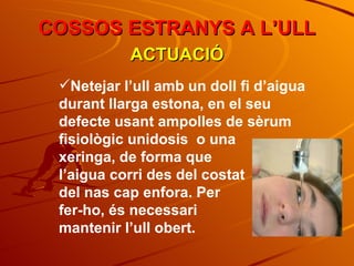 COSSOS ESTRANYS A L’ULL ACTUACIÓ Netejar l’ull amb un doll fi d’aigua durant llarga estona, en el seu defecte usant ampolles de sèrum fisiològic unidosis  o una  xeringa, de forma que  l’aigua corri des del costat  del nas cap enfora. Per  fer-ho, és necessari  mantenir l’ull obert. 
