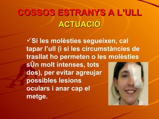 COSSOS ESTRANYS A L’ULL ACTUACIÓ Si les molèsties segueixen, cal tapar l’ull (i si les circumstàncies de trasllat ho permeten o les molèsties són molt intenses, tots  dos), per evitar agreujar  possibles lesions  oculars i anar cap el  metge. 