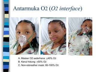 Masker O2r 10-01 Tatalaksana anak dg ggn respiratori 2.ppt