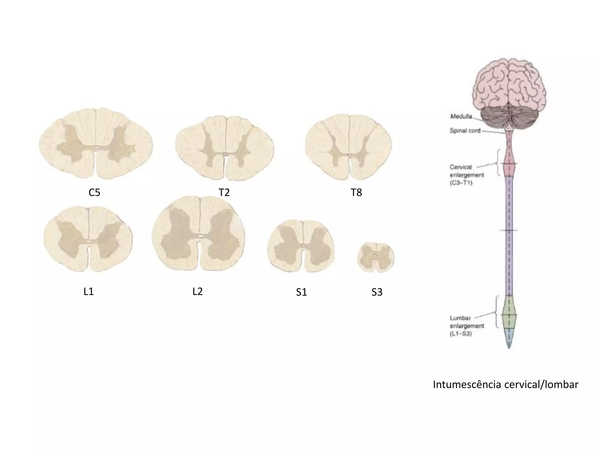 C5 T2 T8
L1 L2 S1 S3
Intumescência cervical/lombar
 