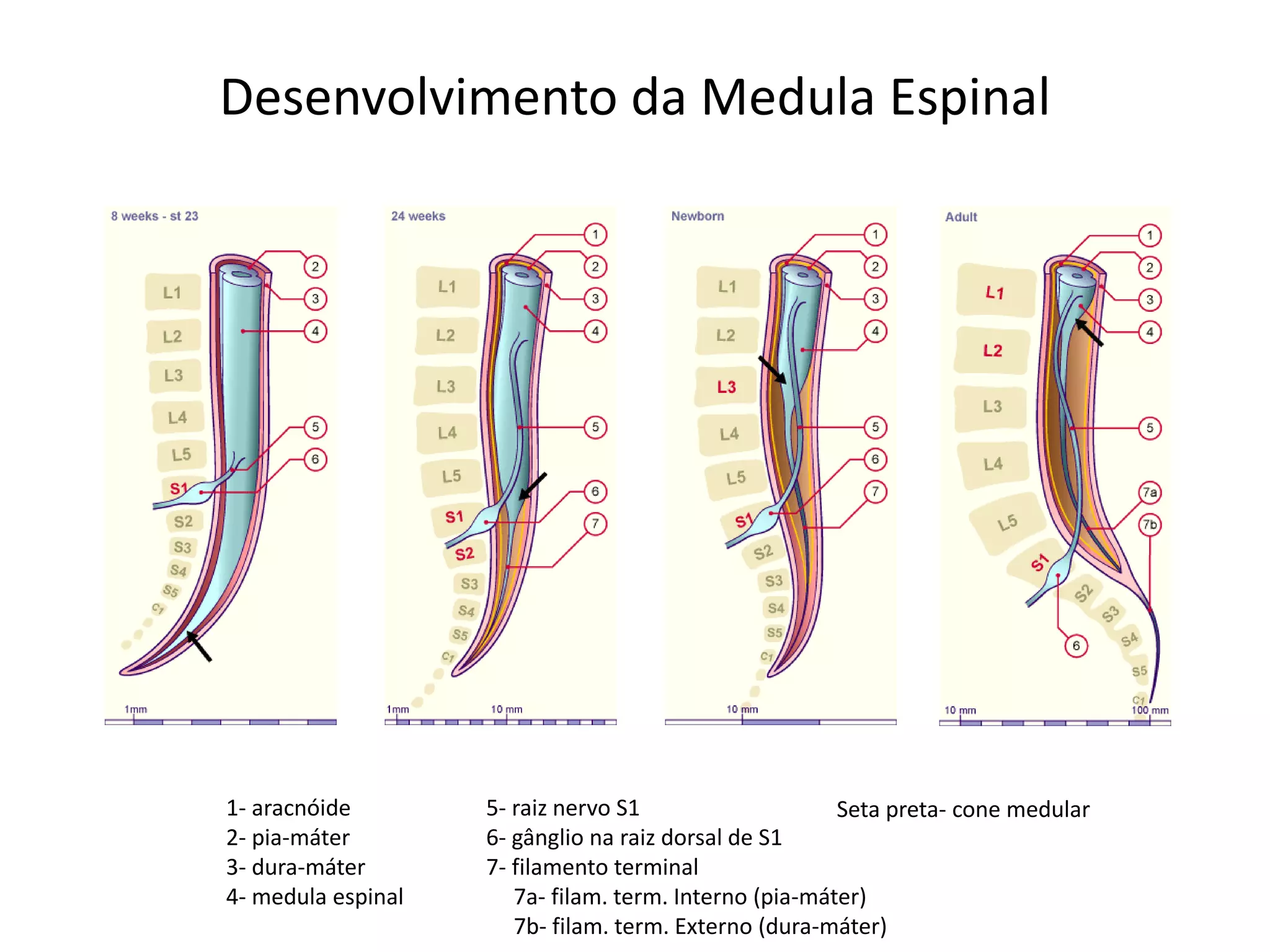Desenvolvimento da Medula Espinal
1- aracnóide
2- pia-máter
3- dura-máter
4- medula espinal
5- raiz nervo S1
6- gânglio na raiz dorsal de S1
7- filamento terminal
7a- filam. term. Interno (pia-máter)
7b- filam. term. Externo (dura-máter)
Seta preta- cone medular
 