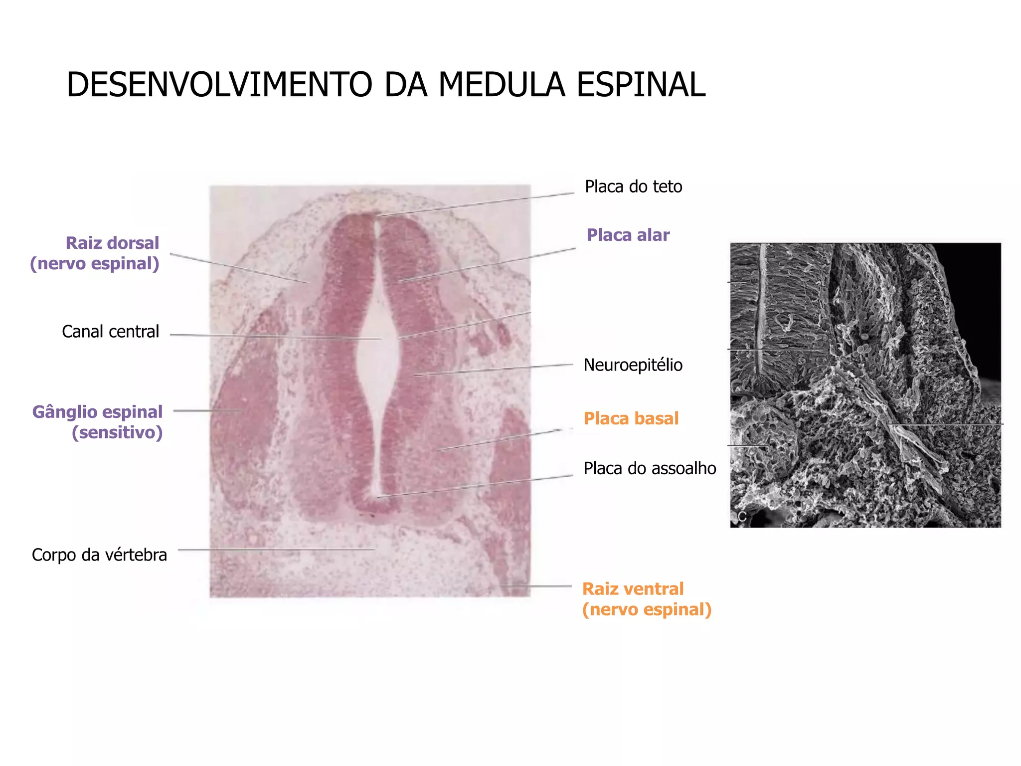 DESENVOLVIMENTO DA MEDULA ESPINAL
Placa do teto
Placa do assoalho
Placa basal
Placa alar
Neuroepitélio
Raiz ventral
(nervo espinal)
Corpo da vértebra
Gânglio espinal
(sensitivo)
Canal central
Raiz dorsal
(nervo espinal)
 
