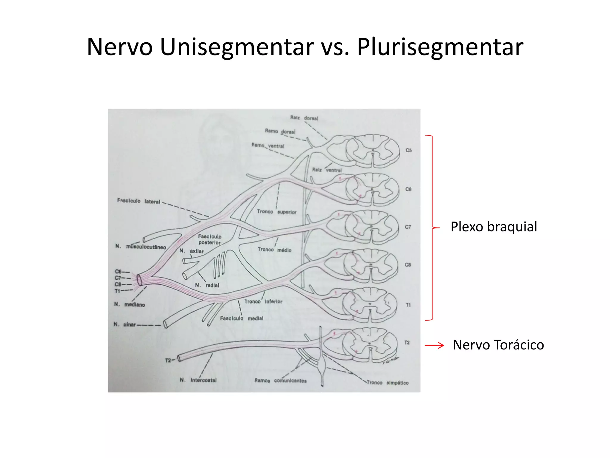 Plexo braquial
Nervo Torácico
Nervo Unisegmentar vs. Plurisegmentar
 