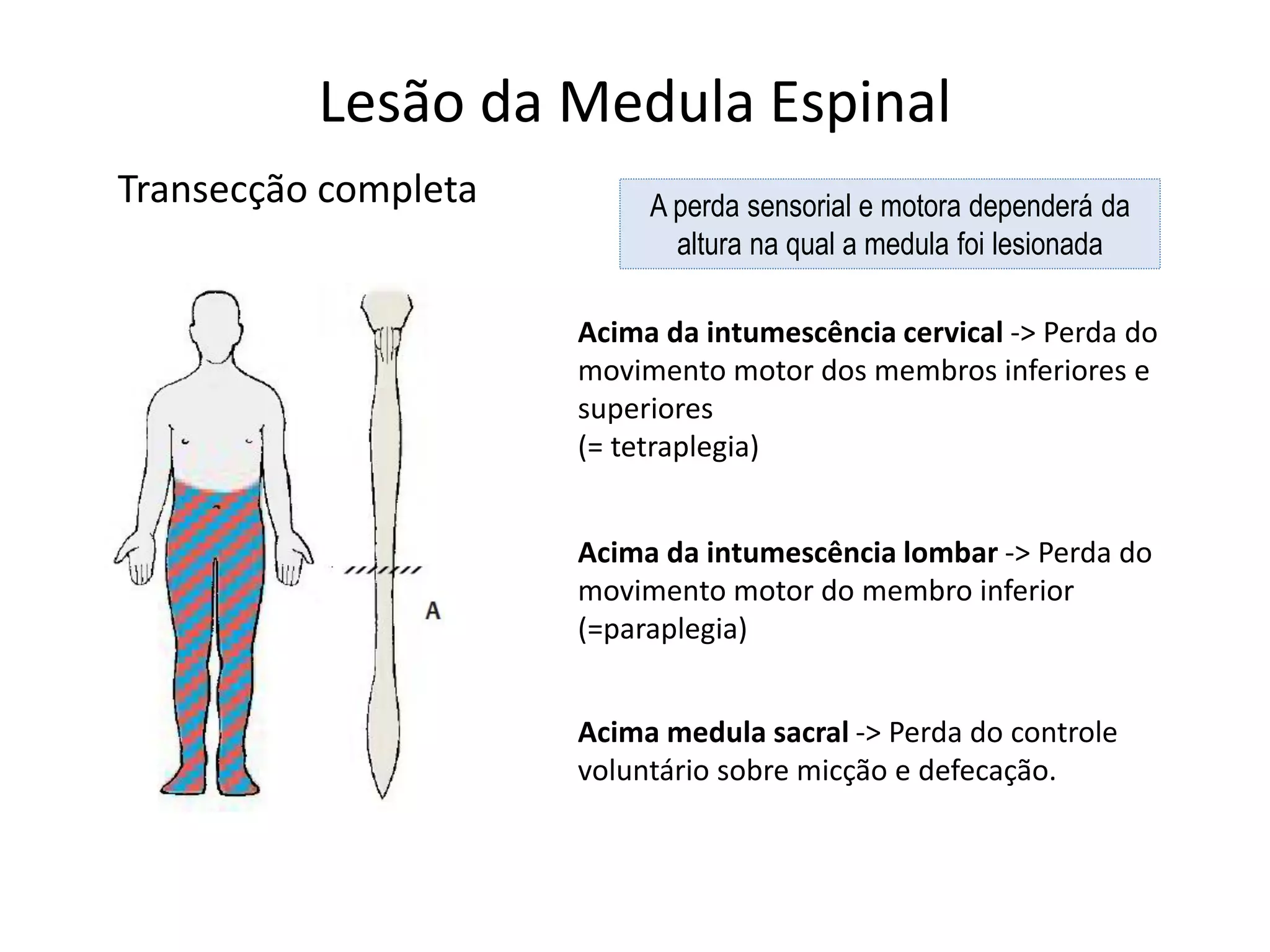 Lesão da Medula Espinal
Transecção completa
Acima medula sacral -> Perda do controle
voluntário sobre micção e defecação.
Acima da intumescência lombar -> Perda do
movimento motor do membro inferior
(=paraplegia)
Acima da intumescência cervical -> Perda do
movimento motor dos membros inferiores e
superiores
(= tetraplegia)
A perda sensorial e motora dependerá da
altura na qual a medula foi lesionada
 