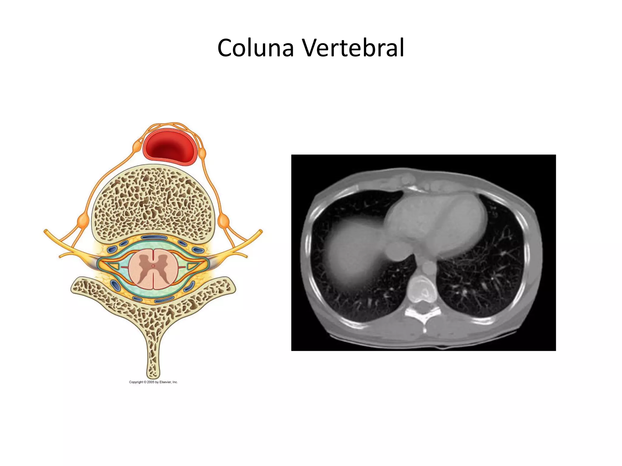 Coluna Vertebral
 
