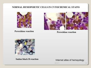 09/14/11 Internet atlas of hemayology NORMAL HEMOPOIETIC CELLS IN CYTOCHEMICAL STAINS Peroxidase reaction Peroxidase reaction S udan black B reaction 
