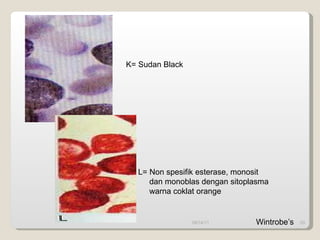 09/14/11 K= Sudan Black L= Non spesifik esterase, monosit  dan monoblas dengan sitoplasma warna coklat orange Wintrobe’s 