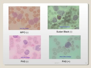 09/14/11 MPO (-) Sudan Black (-) PAS (-) PAS (+) 