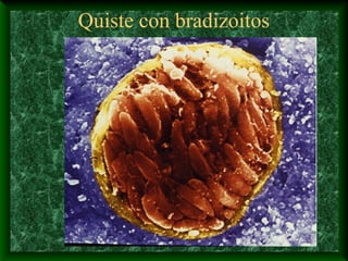 Quiste con bradizoitos
 