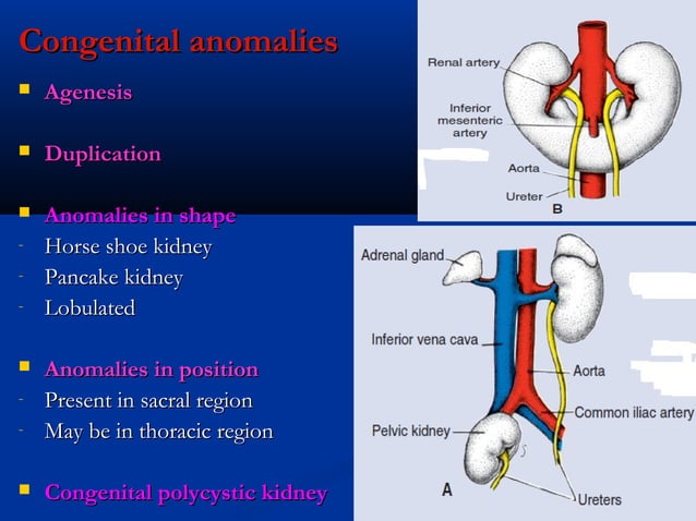 10.development of urogenital system | PPT