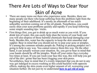 There Are Lots of Ways to Clear Your Skin of Acne There are many teens out there who experience acne. Besides, there are many people out there who keep suffering from this problem right from the beginning of their adulthood. It’s mostly an aftermath of too much unhealthy secretion coming out of the oil glands. Nonetheless, you could easily shun your acne problems quickly and rapidly if you keep following some simple sounding tips / tricks. First things first, you got to drink up as much water as you wish. If you drink lots of water, this can easily help shun the toxins of your body and you will also dispose of those harmful chemicals that keep damaging your body. Besides this, water has the capacity to keep the skin smoother and suppler. Bear in mind that you should not try to pop your acne or pimples. It’s among the common mistake people do. Poking or picking pimples isn’t going to help in any way. You cannot remove them this way. On the other hand, it can actually worsen your situation. So, you got to bear in mind that your hands should be off the pimples. Wash off your entire face everyday two times at least. If you can wash your face this way, this will help you get rid of the dirt / grime that has been clogging your skin pores. Nevertheless, bear in mind that it’s evenly important that you do not in any way get indulged in excess washing as this could backfire with opposite effects, making the skin create even higher amount of oil, worsening your situation further. Do not just try to understand how to get rid of acne. 