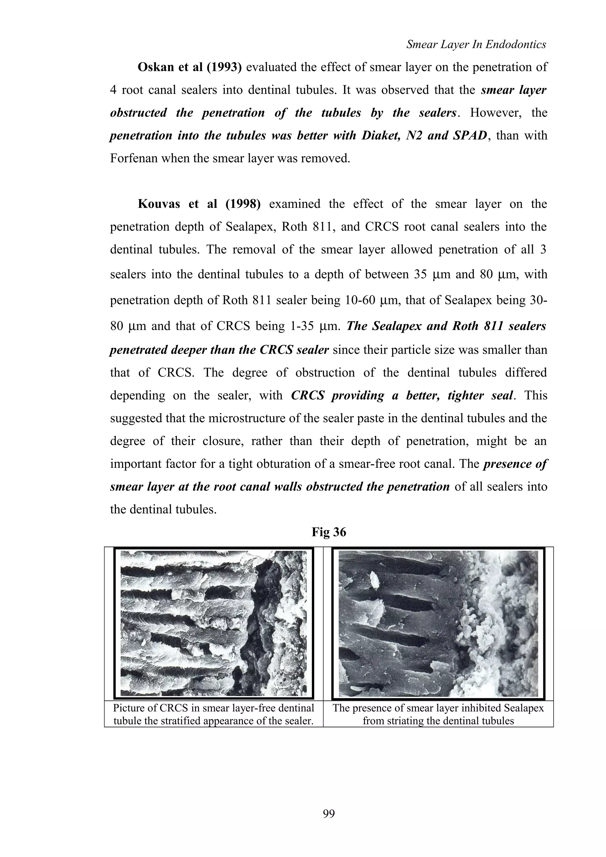 Smear Layer In Endodontics
Oskan et al (1993) evaluated the effect of smear layer on the penetration of
4 root canal sealers into dentinal tubules. It was observed that the smear layer
obstructed the penetration of the tubules by the sealers. However, the
penetration into the tubules was better with Diaket, N2 and SPAD, than with
Forfenan when the smear layer was removed.
Kouvas et al (1998) examined the effect of the smear layer on the
penetration depth of Sealapex, Roth 811, and CRCS root canal sealers into the
dentinal tubules. The removal of the smear layer allowed penetration of all 3
sealers into the dentinal tubules to a depth of between 35 µm and 80 µm, with
penetration depth of Roth 811 sealer being 10-60 µm, that of Sealapex being 30-
80 µm and that of CRCS being 1-35 µm. The Sealapex and Roth 811 sealers
penetrated deeper than the CRCS sealer since their particle size was smaller than
that of CRCS. The degree of obstruction of the dentinal tubules differed
depending on the sealer, with CRCS providing a better, tighter seal. This
suggested that the microstructure of the sealer paste in the dentinal tubules and the
degree of their closure, rather than their depth of penetration, might be an
important factor for a tight obturation of a smear-free root canal. The presence of
smear layer at the root canal walls obstructed the penetration of all sealers into
the dentinal tubules.
Fig 36
Picture of CRCS in smear layer-free dentinal
tubule the stratified appearance of the sealer.
The presence of smear layer inhibited Sealapex
from striating the dentinal tubules
99
 