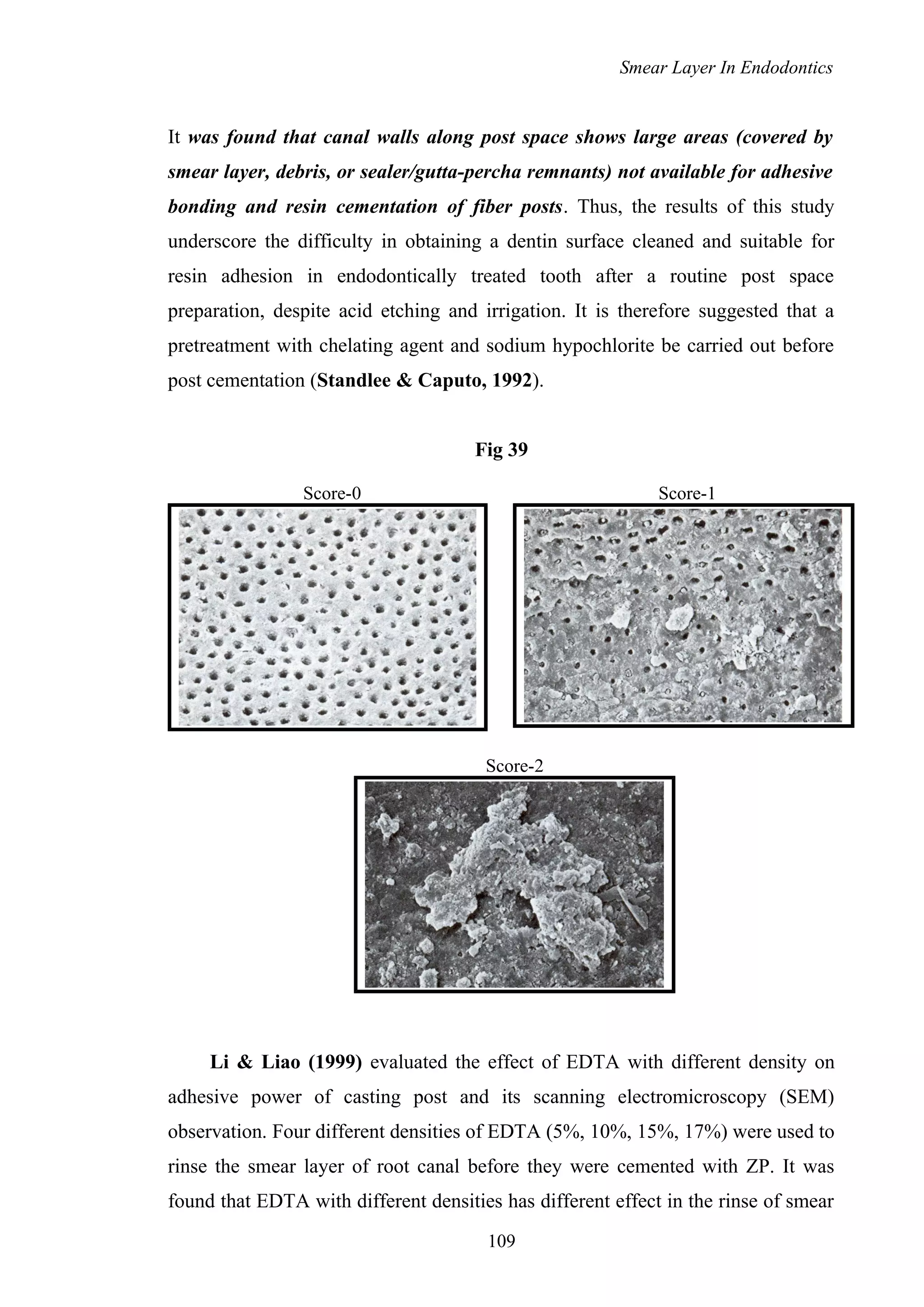 Smear Layer In Endodontics
It was found that canal walls along post space shows large areas (covered by
smear layer, debris, or sealer/gutta-percha remnants) not available for adhesive
bonding and resin cementation of fiber posts. Thus, the results of this study
underscore the difficulty in obtaining a dentin surface cleaned and suitable for
resin adhesion in endodontically treated tooth after a routine post space
preparation, despite acid etching and irrigation. It is therefore suggested that a
pretreatment with chelating agent and sodium hypochlorite be carried out before
post cementation (Standlee & Caputo, 1992).
Fig 39
Score-0 Score-1
Score-2
Li & Liao (1999) evaluated the effect of EDTA with different density on
adhesive power of casting post and its scanning electromicroscopy (SEM)
observation. Four different densities of EDTA (5%, 10%, 15%, 17%) were used to
rinse the smear layer of root canal before they were cemented with ZP. It was
found that EDTA with different densities has different effect in the rinse of smear
109
 