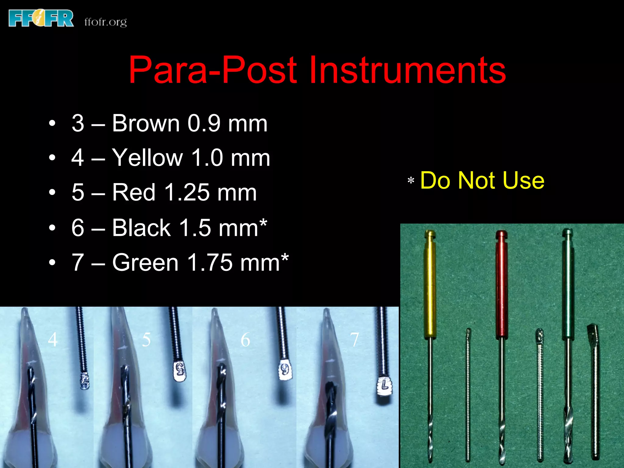 Para-Post Instruments
•  3 – Brown 0.9 mm
•  4 – Yellow 1.0 mm
•  5 – Red 1.25 mm
•  6 – Black 1.5 mm*
•  7 – Green 1.75 mm*
4 5 6 7
* Do Not Use
 