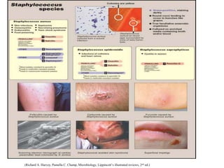 (Richard A. Harvey, Pamella C. Champ, Microbiology, Lippincott’s illustrated reviews, 2nd ed.)
 