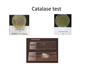 Catalase test
 