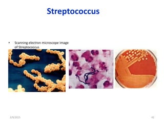 Streptococcus
• Scanning electron microscope image
of Streptococcus
2/9/2015 42
 