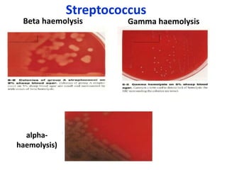 Beta haemolysis
alpha-
haemolysis)
Gamma haemolysis
Streptococcus
 