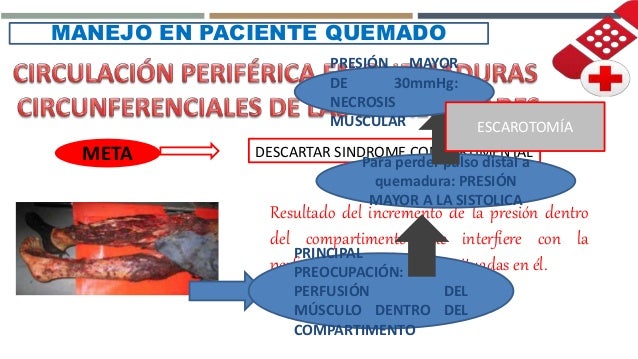 Manejo del Paciente Quemado
