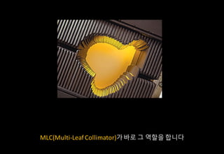 MLC(Multi-Leaf	Collimator)??? ? ??? ???
 