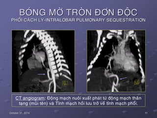 11October 31, 2014
BOÙNG MÔØ TROØN ÑÔN ÑOÄC
PHOÅI CAÙCH LY-INTRALOBAR PULMONARY SEQUESTRATION
CT angiogram: Ñoäng maïch nu...