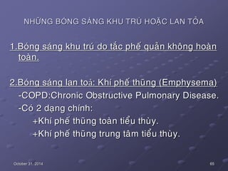 65October 31, 2014
NHÖÕNG BOÙNG SAÙNG KHU TRUÙ HOAËC LAN TOÛA
1.Boùng saùng khu truù do taéc pheá quaûn khoâng hoaøn
toaøn...