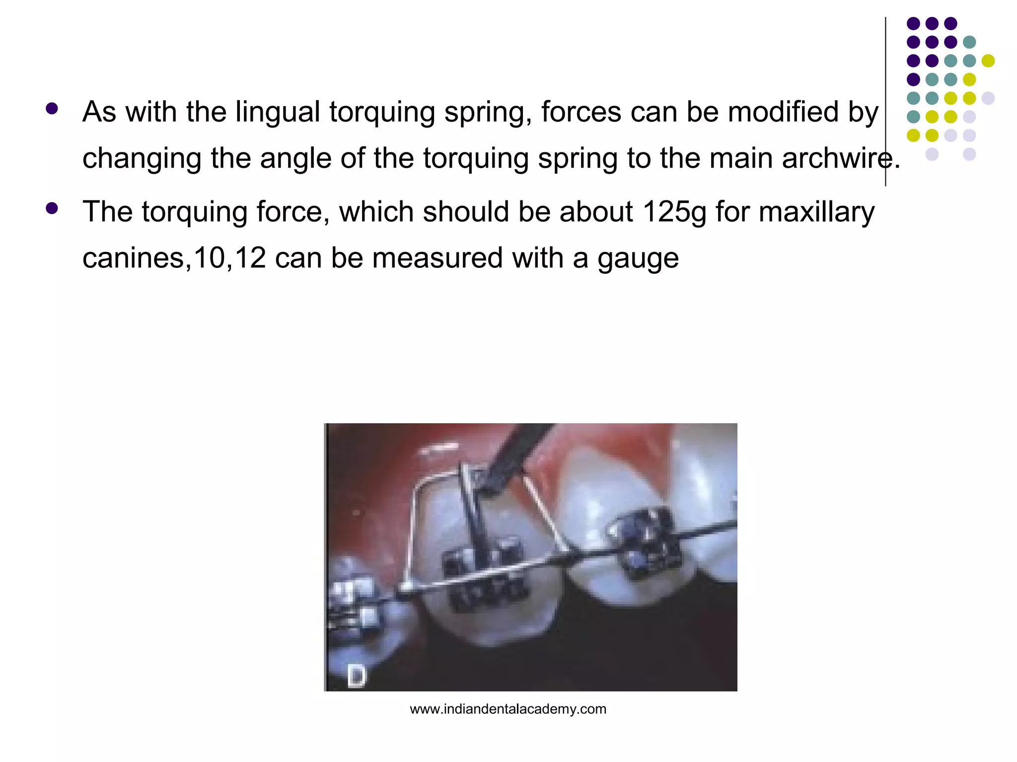 palatal and buccal root torquing springs. jco 2002. | PPT