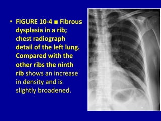 The Chest Wall, Pleura, Diaphragm and Intervention 10 Dr. Muhammad Bin ...
