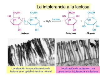 La intolerancia a la lactosa
Localización inmunocitoquimica de
lactasa en el epitelio intestinal normal
Localización de lactasa en una
persona con intolerancia a la lactosa
 