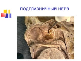 ПОДГЛАЗНИЧНЫЙ НЕРВ
 