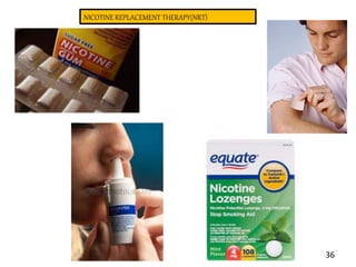 NICOTINE REPLACEMENT THERAPY(NRT)
36
 