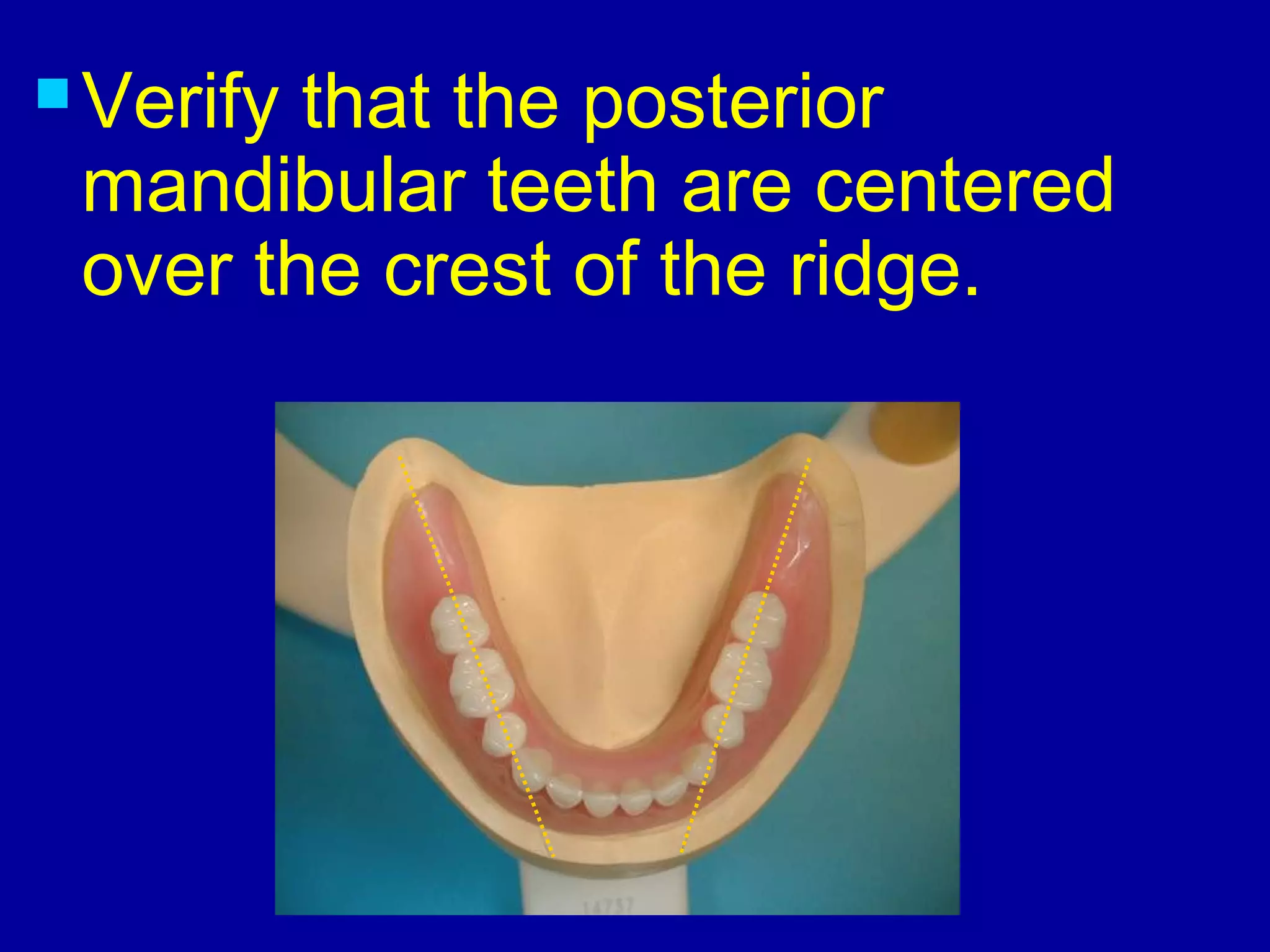 10. posterior teeth arrangement | PPT