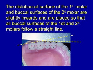 The distobuccal surface of the 1st
molar
and buccal surfaces of the 2nd
molar are
slightly inwards and are placed so that
all buccal surfaces of the 1st and 2nd
molars follow a straight line.
 