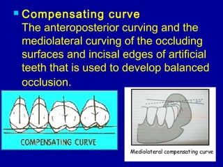  Compensating curve
The anteroposterior curving and the
mediolateral curving of the occluding
surfaces and incisal edges of artificial
teeth that is used to develop balanced
occlusion.
 