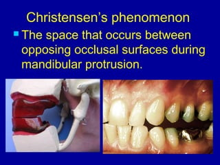 Christensen’s phenomenon
 The space that occurs between
opposing occlusal surfaces during
mandibular protrusion.
 