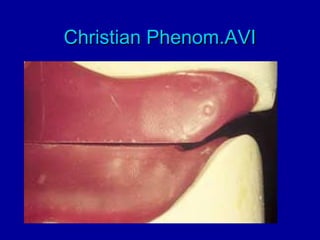 Christian Phenom.AVIChristian Phenom.AVI
 