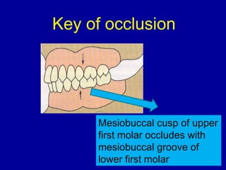 Mesiobuccal cusp of upper
first molar occludes with
mesiobuccal groove of
lower first molar
Key of occlusion
 
